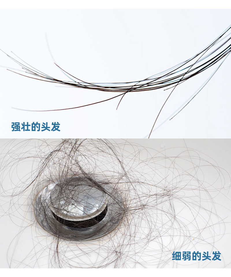 5个简单的脱发自测法,在家就能做_刘长春_主任医师_爱问健康