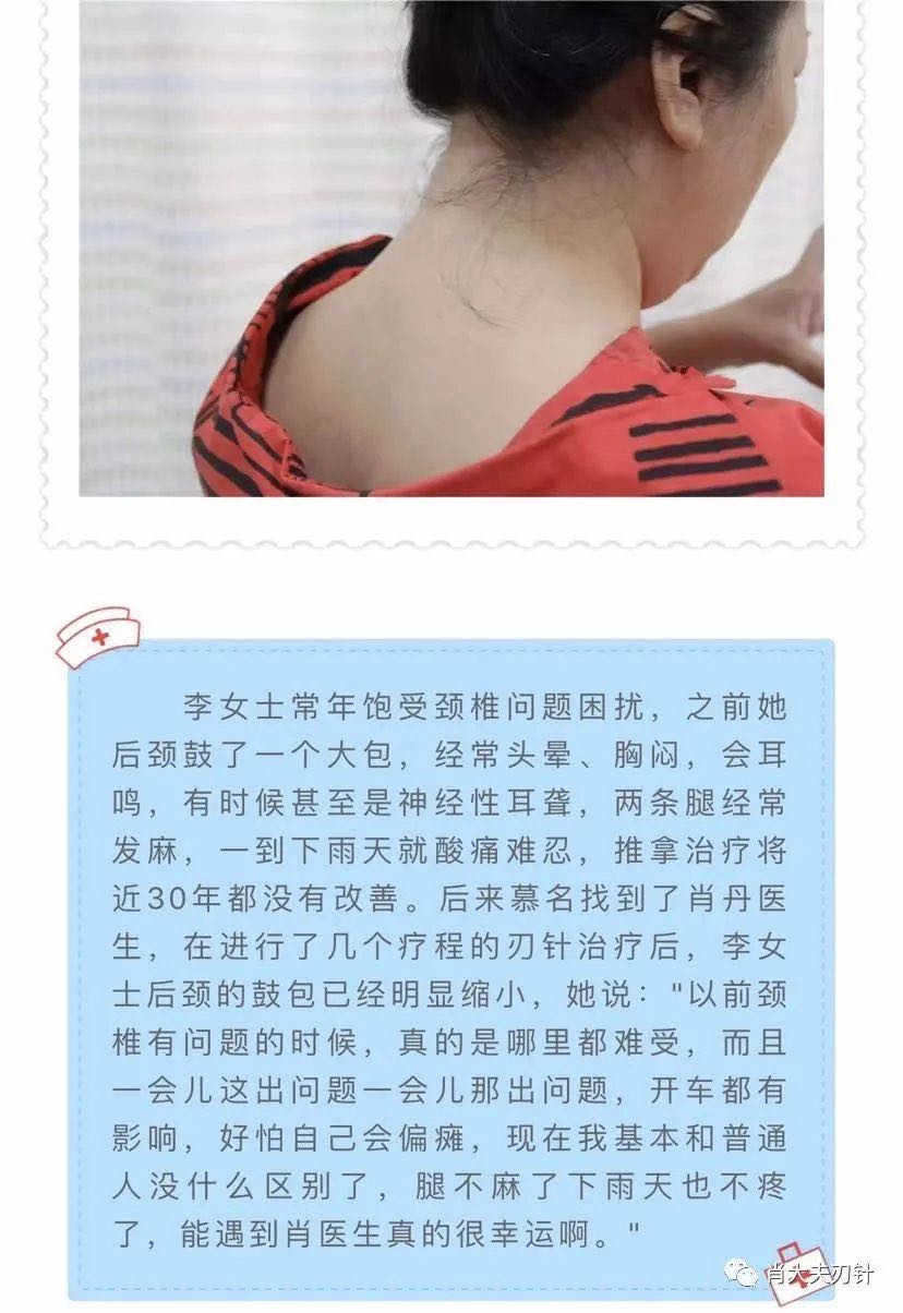 肖氏刃针手法|“针消富贵包”,譬如“扎针耕田,老肉翻新”_肖丹_副主任医师_爱问健康